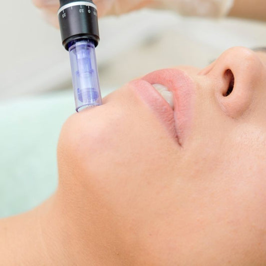 FACIAL CON MICROAGUJAS